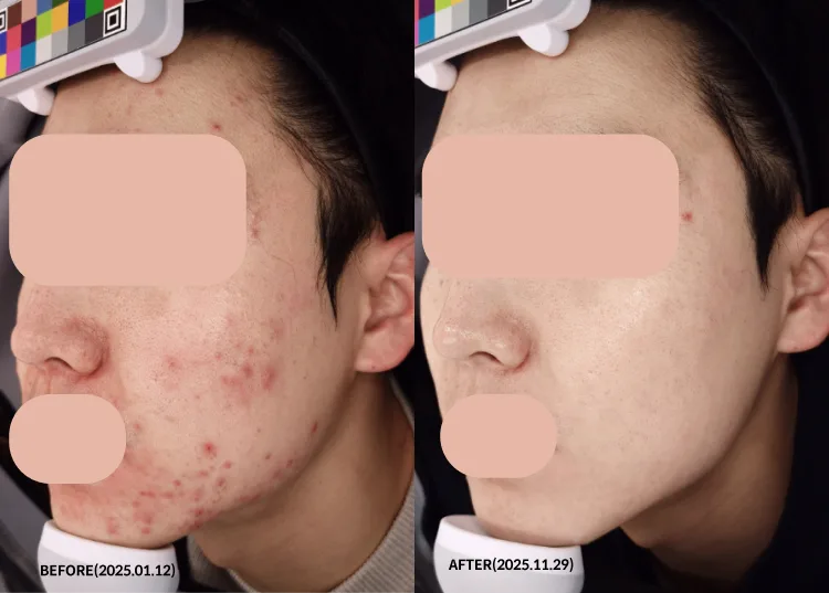 我将产生显著的效果。