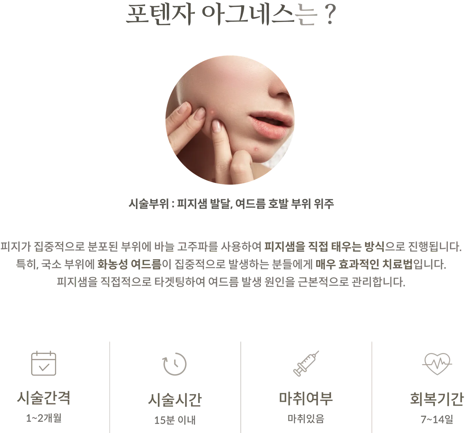 Potenza黄金微针 Agnes施术信息面板：施术区域主要针对皮脂腺发育和易长痤疮的区域；解释使用针式射频直接烧灼皮脂腺的方法；施术间隔 1-2 个月；施术时间不超过 15 分钟；采用麻醉；恢复期 7-14 天。