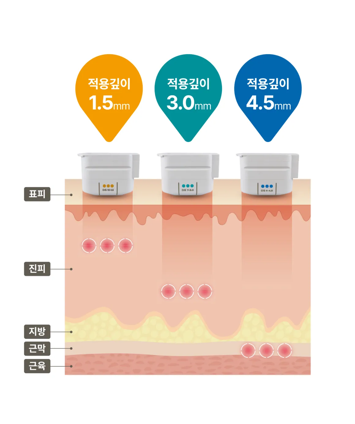 3 个按应用深度划分的技巧图