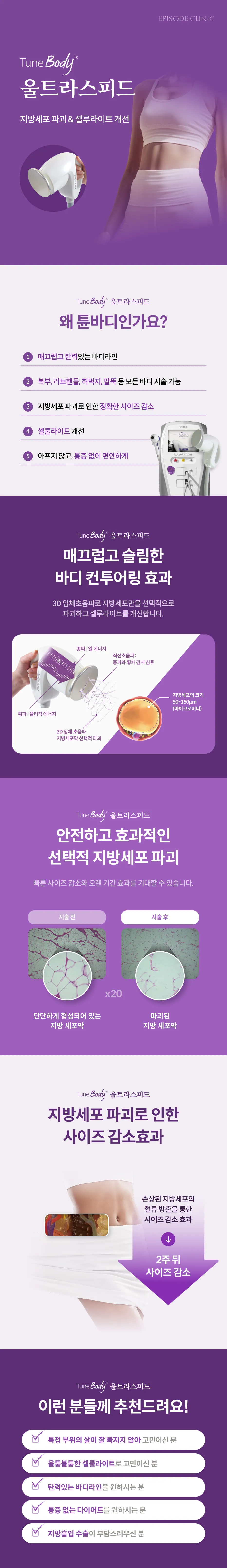 TuneBody UltraSpeed 详细指南:脂肪细胞破坏和橘皮组织管理、选择 TuneBody 的 5 个理由、Alma Accent Prime 设备、3D 超声原理图、脂肪细胞膜的治疗前后组织图像、尺寸缩小过程、适用人群指南