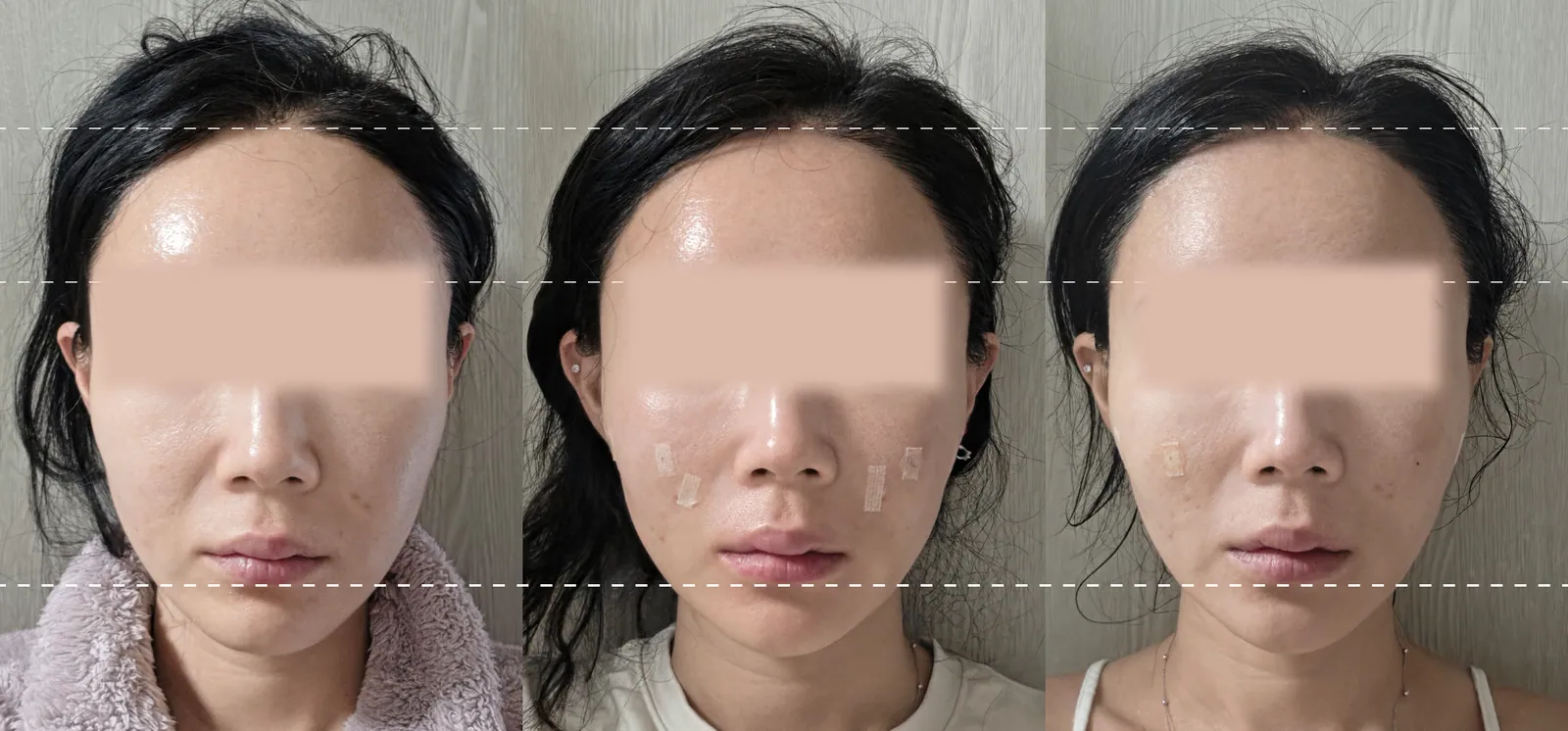 塑形前后对比照片